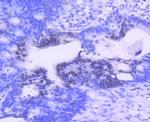 PIM1 Antibody in Immunohistochemistry (Paraffin) (IHC (P))