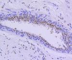 PIM1 Antibody in Immunohistochemistry (Paraffin) (IHC (P))