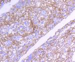 SRC Antibody in Immunohistochemistry (Paraffin) (IHC (P))