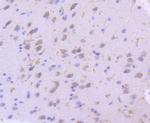 SGK1 Antibody in Immunohistochemistry (Paraffin) (IHC (P))