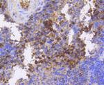 Phospho-eIF4E (Ser209) Antibody in Immunohistochemistry (Paraffin) (IHC (P))