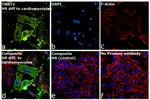 Cardiac Troponin T Antibody