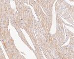 Cardiac Troponin T Antibody in Immunohistochemistry (Paraffin) (IHC (P))