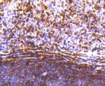 STAT5 alpha Antibody in Immunohistochemistry (Paraffin) (IHC (P))