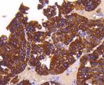 SHH Antibody in Immunohistochemistry (Paraffin) (IHC (P))