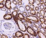 SHH Antibody in Immunohistochemistry (Paraffin) (IHC (P))