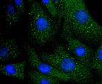 ILK Antibody in Immunocytochemistry (ICC/IF)