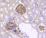 IRF7 Antibody in Immunohistochemistry (Paraffin) (IHC (P))