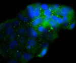 NSE Antibody in Immunocytochemistry (ICC/IF)