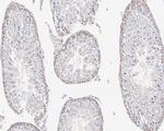 SHP2 Antibody in Immunohistochemistry (Paraffin) (IHC (P))