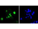 SOX9 Antibody in Immunocytochemistry (ICC/IF)