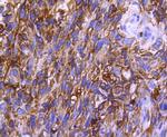 CCR2 Antibody in Immunohistochemistry (Paraffin) (IHC (P))