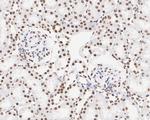 BRG1 Antibody in Immunohistochemistry (Paraffin) (IHC (P))