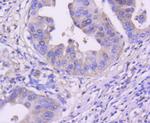 CDK4 Antibody in Immunohistochemistry (Paraffin) (IHC (P))