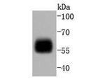 IRF5 Antibody in Western Blot (WB)