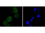 CDK4 Antibody in Immunocytochemistry (ICC/IF)