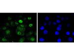 CDK4 Antibody in Immunocytochemistry (ICC/IF)