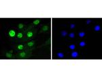 CDK4 Antibody in Immunocytochemistry (ICC/IF)