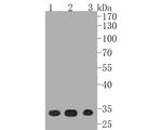 CDK4 Antibody in Western Blot (WB)