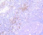 RUNX2 Antibody in Immunohistochemistry (Paraffin) (IHC (P))