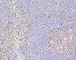 JunB Antibody in Immunohistochemistry (Paraffin) (IHC (P))