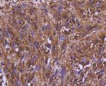 MEK2 Antibody in Immunohistochemistry (Paraffin) (IHC (P))