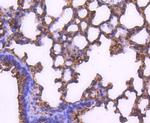 MEK2 Antibody in Immunohistochemistry (Paraffin) (IHC (P))