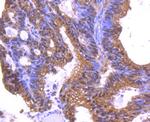 14-3-3 epsilon Antibody in Immunohistochemistry (Paraffin) (IHC (P))