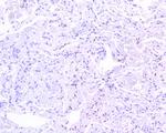 Phospho-STAT3 (Tyr705) Antibody in Immunohistochemistry (Paraffin) (IHC (P))