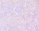 Phospho-STAT3 (Tyr705) Antibody in Immunohistochemistry (Paraffin) (IHC (P))