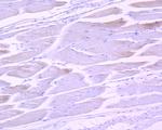 Phospho-STAT3 (Tyr705) Antibody in Immunohistochemistry (Paraffin) (IHC (P))