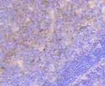 ITGA5 Antibody in Immunohistochemistry (Paraffin) (IHC (P))