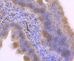 ITGA5 Antibody in Immunohistochemistry (Paraffin) (IHC (P))