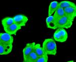 FASN Antibody in Immunocytochemistry (ICC/IF)