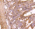 FASN Antibody in Immunohistochemistry (Paraffin) (IHC (P))