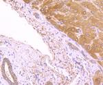 FASN Antibody in Immunohistochemistry (Paraffin) (IHC (P))