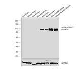 alpha Actinin 2 Antibody in Western Blot (WB)