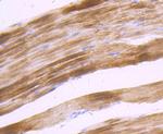 alpha Actinin 2 Antibody in Immunohistochemistry (Paraffin) (IHC (P))