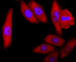 SOD1 Antibody in Immunocytochemistry (ICC/IF)