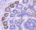 PDGFRA Antibody in Immunohistochemistry (Paraffin) (IHC (P))