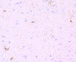 PDGFRA Antibody in Immunohistochemistry (Paraffin) (IHC (P))