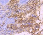 PDGFRA Antibody in Immunohistochemistry (Paraffin) (IHC (P))