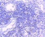 Bcl-2 Antibody in Immunohistochemistry (Paraffin) (IHC (P))