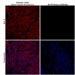 Bcl-2 Antibody in Immunohistochemistry (Paraffin) (IHC (P))