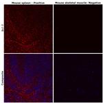 Bcl-2 Antibody in Immunohistochemistry (Paraffin) (IHC (P))