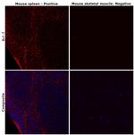 Bcl-2 Antibody in Immunohistochemistry (Paraffin) (IHC (P))