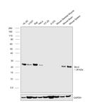 Bcl-2 Antibody