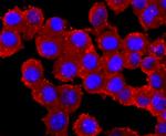 Parkin Antibody in Immunocytochemistry (ICC/IF)