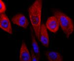 Parkin Antibody in Immunocytochemistry (ICC/IF)