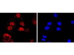 KLF4 Antibody in Immunocytochemistry (ICC/IF)